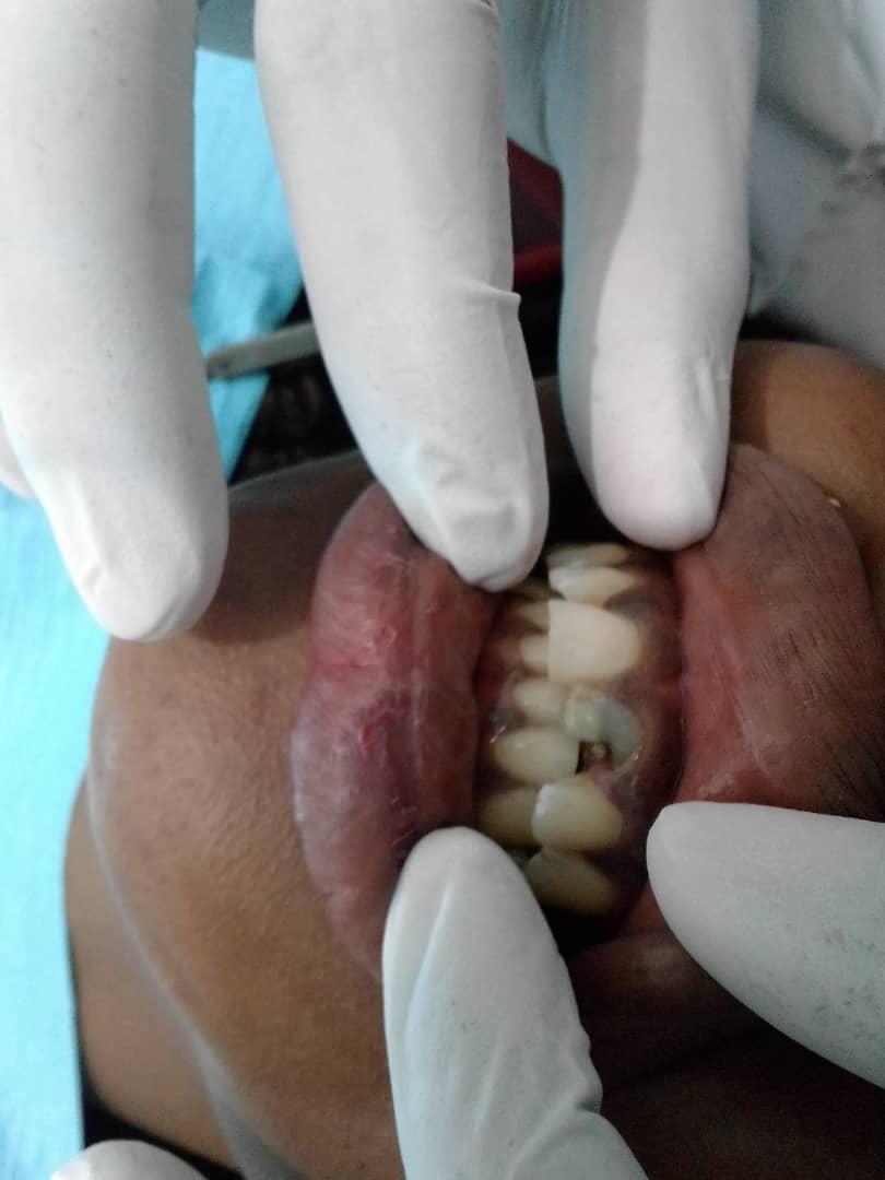 dental10